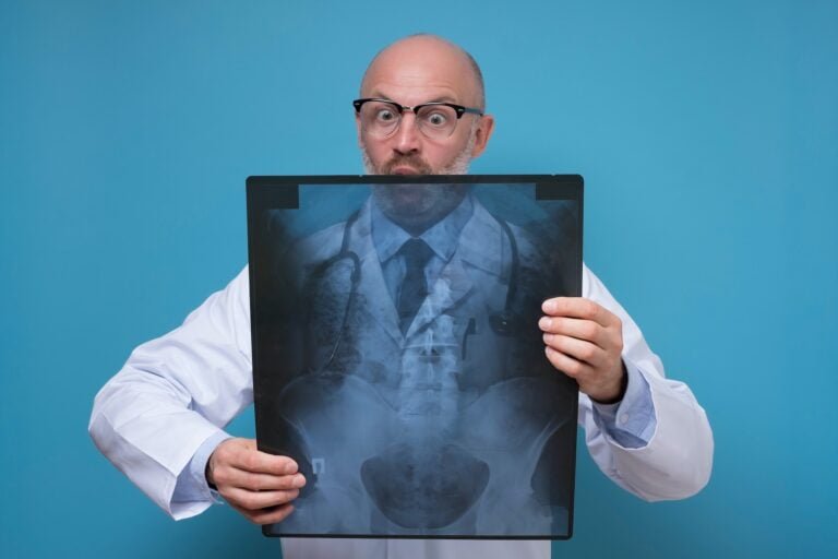 Mature male doctor with x-ray scan of pelvic area